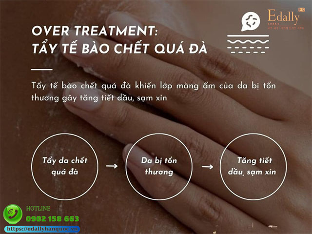 Da sạm xỉn màu do tẩy tế bào chết quá đà