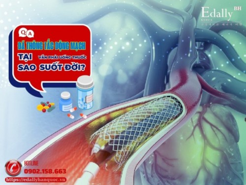 Đã Thông Tắc Động Mạch Tại Sao Vẫn Phải Uống Thuốc Suốt Đời?