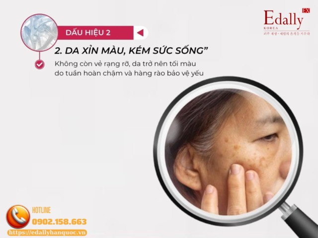 Da xỉn màu, kém sức sống là dấu hiệu làn bị stress vào thời điểm giao mùa Da xỉn màu, kém sức sống là dấu hiệu làn bị stress vào thời điểm giao mùa