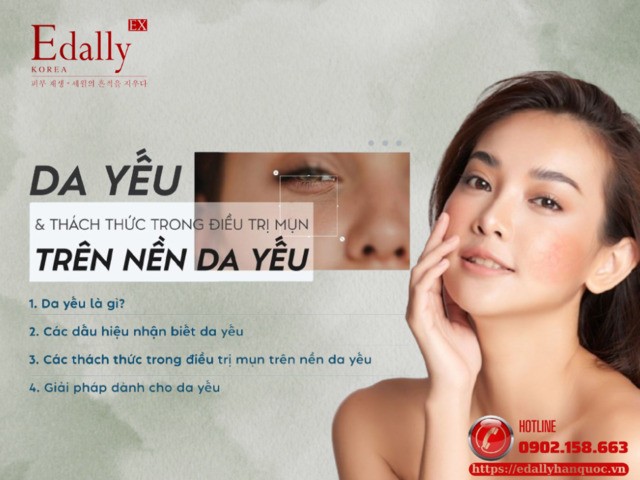 Làn da yếu và thách thức trong điều trị mụn trên nền da yếu
