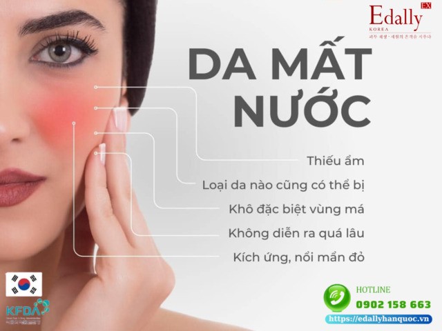 Đặc điểm của làn da bị thiếu nước