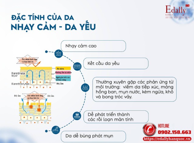 Đặc tính của nền da yếu - nhạy cảm