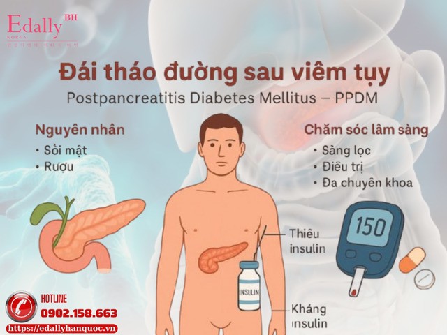 Đái tháo đường sau viêm tụy (PPDM) - Nguyên nhân và cách chăm sóc