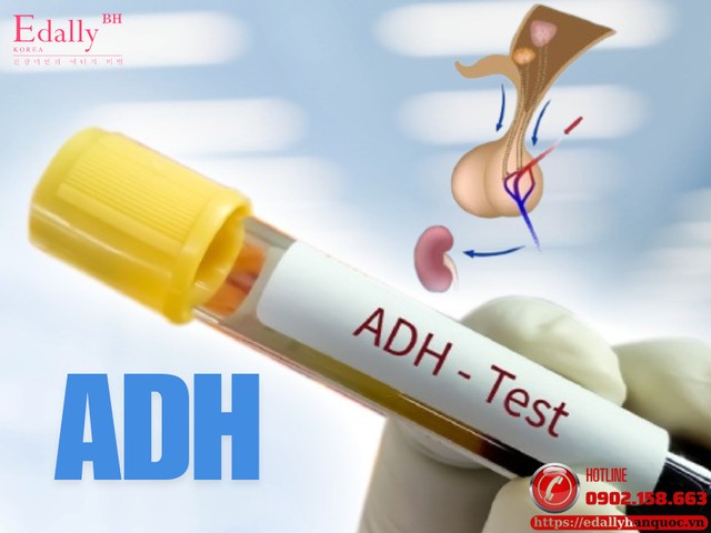 Đái tháo nhạt - đừng để bệnh tiểu nhiều, khát nhiều bị mặc định là đái tháo đường