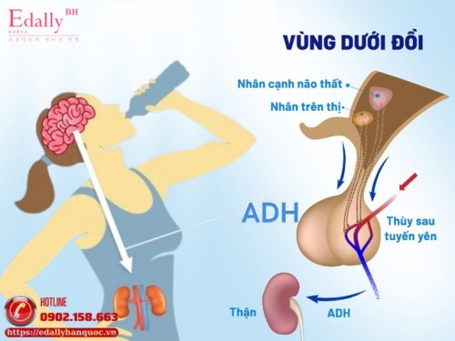 Đái Tháo Nhạt - Đừng Để Bệnh Tiểu Nhiều, Khát Nhiều Bị Mặc Định Là Đái Tháo Đường