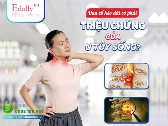 Đau cổ kéo dài có phải là dấu hiệu của u tủy sống không?