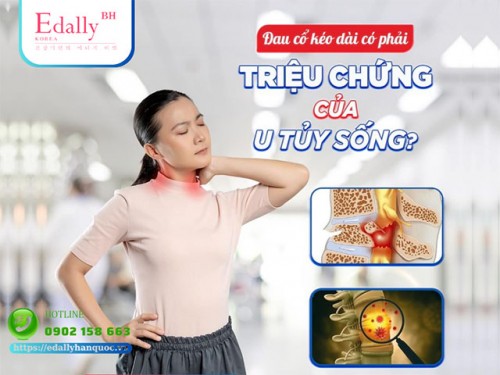 Đau Cổ Kéo Dài Có Phải Triệu Chứng Của U Tủy Sống?