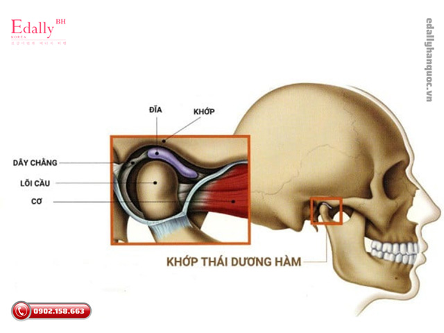 Đau hàm là dấu hiệu cảnh báo rối loạn khớp thái dương hàm