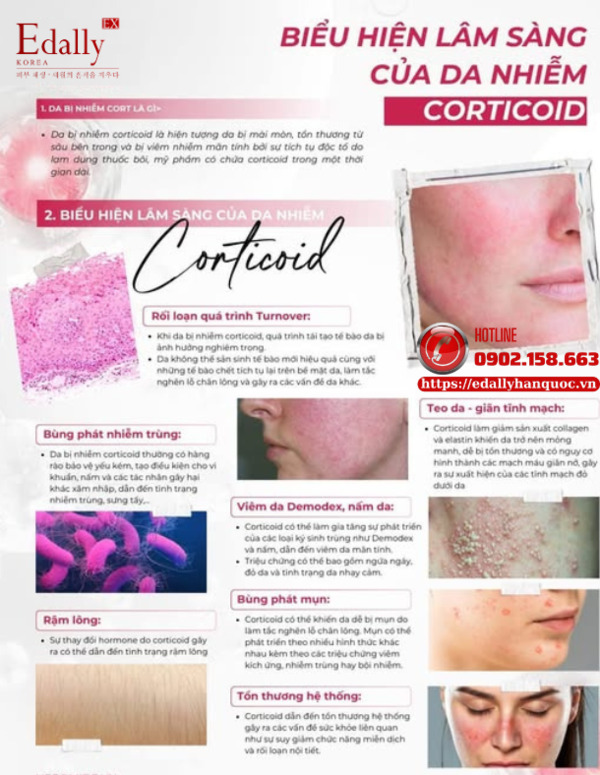 Biểu hiện lân sàng khi da bị nhiễm corticoid
