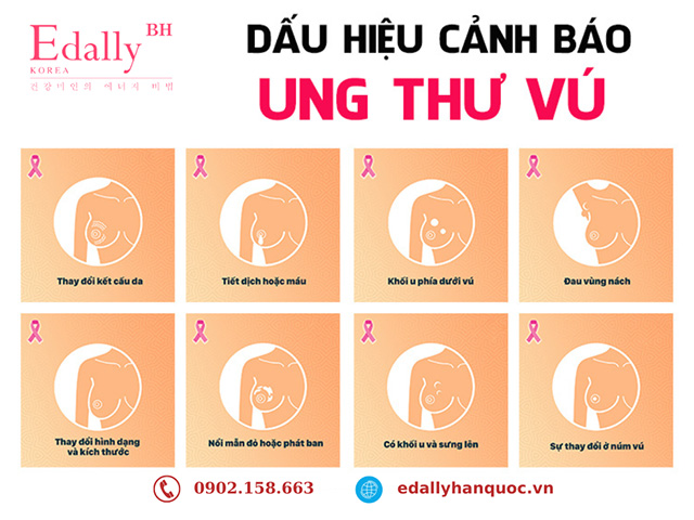 Các triệu chứng của bệnh ung thư vú