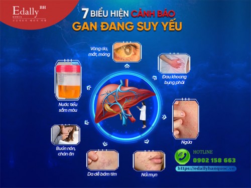 Dấu Hiệu Cảnh Báo Gan Quá Tải Và Cách Cải Thiện