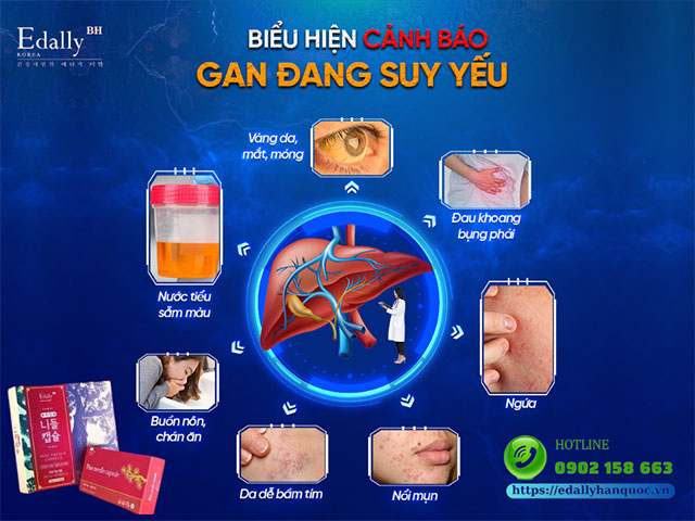 Biểu hiện cảnh báo gan đang bị suy yếu và có vấn đề