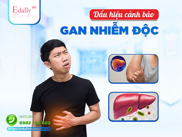 Dấu hiệu cảnh báo tình trạng gan bị nhiễm độc tố