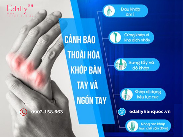 Dấu hiệu cảnh báo thoái hóa khớp bàn tay và ngón tay