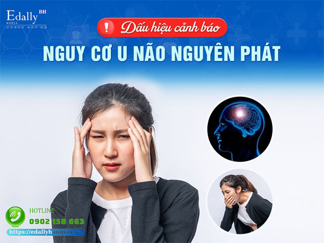 Dấu hiệu cảnh báo nguy cơ u não nguyên phát