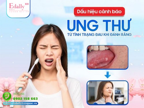 Dấu Hiệu Cảnh Báo Ung Thư Lưỡi Và Cách Phòng Chống