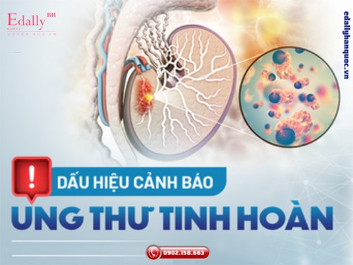 Dấu Hiệu Cảnh Báo Ung Thư Tinh Hoàn