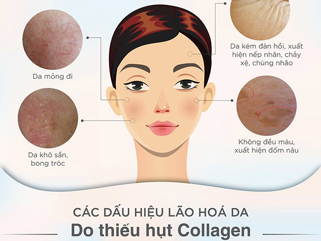 Các dấu hiệu của lão hóa da do thiếu hụt collagen trong cơ thể