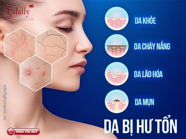 Dấu hiệu nhận biết làn da bị hư tổn nặng nề