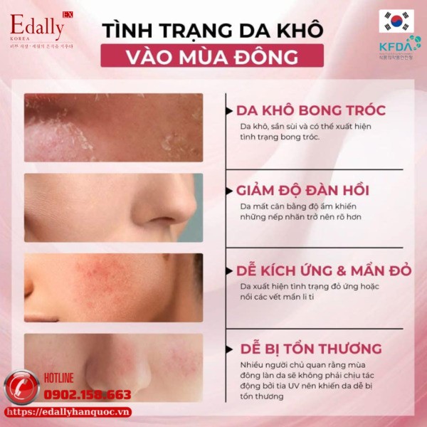 Dấu hiệu da khô nẻ vào mùa đông Dấu hiệu da khô nẻ vào mùa đông