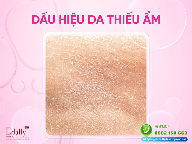 Dấu hiệu của làn da bị thiếu nước