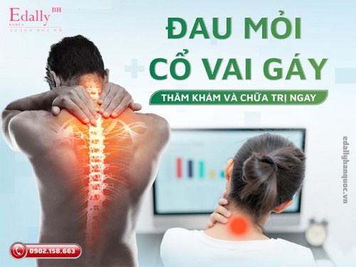 Dấu Hiệu Đau Mỏi Cổ Vai Gáy Cảnh Báo Nguy Hiểm