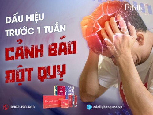 Dấu Hiệu Đột Quỵ Trước 1 Tuần