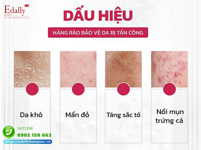 Dấu hiệu hàng rào bảo vệ da bị suy yếu