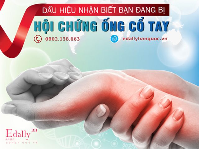 Dấu hiệu nhận biết hội chứng ống cổ tay