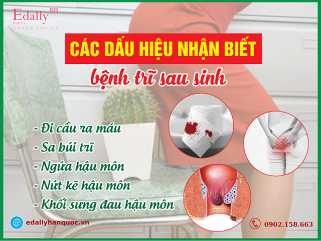 Các dấu hiệu nhận biết bệnh trĩ khi mang thai và sau sinh