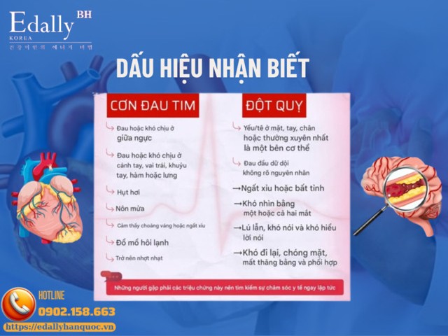 Dấu hiệu nhận biết cơn đau tim và đột quỵ não