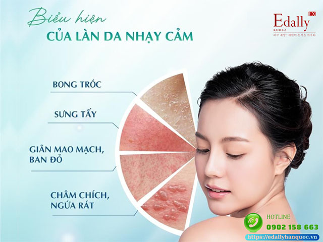 Biểu hiện của làn da nhạy cảm như thế nào?