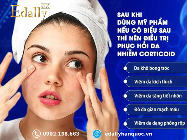 Dấu hiệu nhận biết làn da bị nhiễm Corticoid