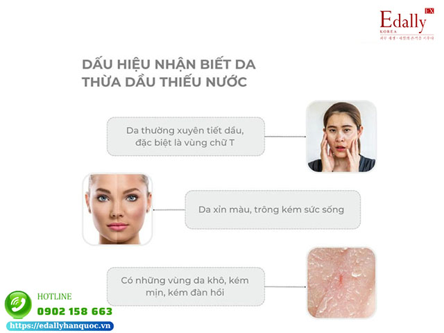 Dấu hiệu của làn da thừa dầu thiếu nước