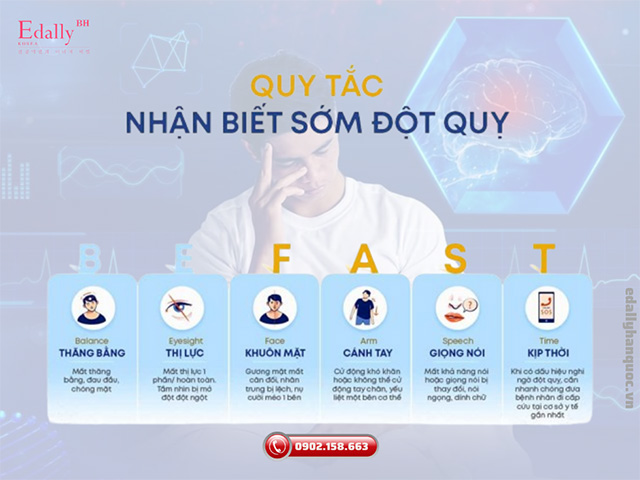 Dấu hiệu sớm nhận biết đột quỵ