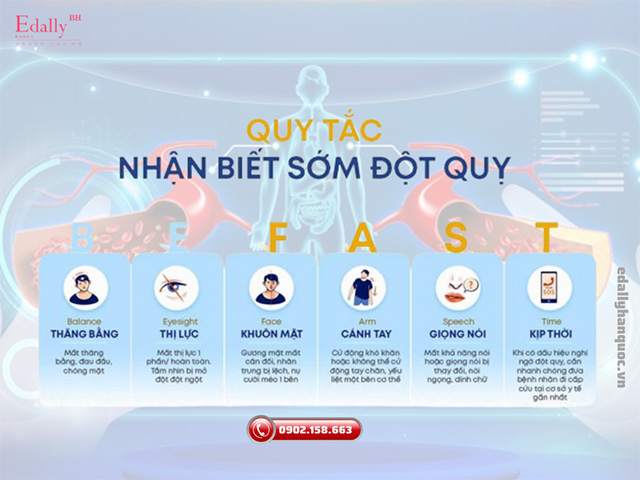 Dấu hiệu nhận biết sớm đột quỵ ở dân văn phòng