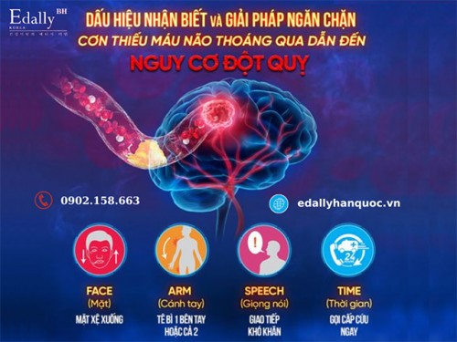 Cơn Thiếu Máu Não Thoáng Qua Có Nguy Hiểm Không?