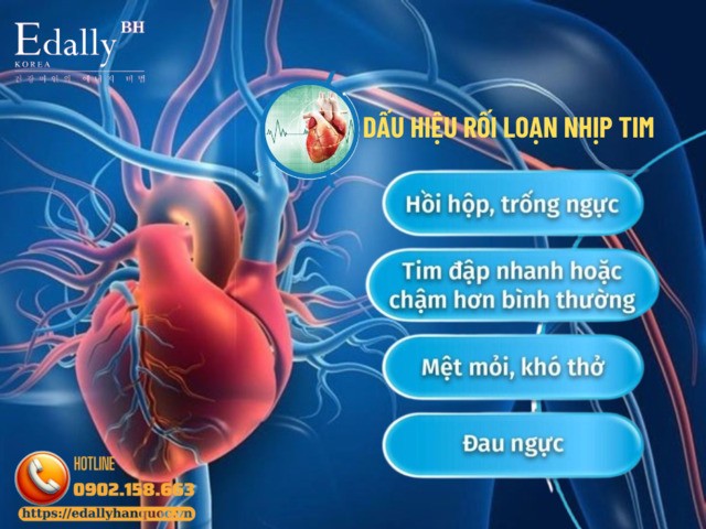 Dấu hiệu nhận biết của bệnh rối loạn nhịp tim