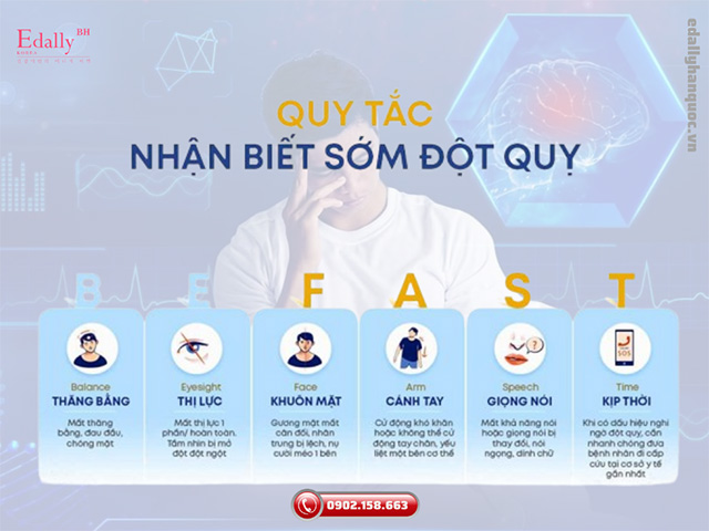 Dấu hiệu sớm nhận biết cơn đột quỵ não