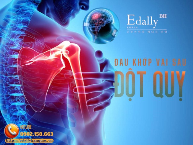 Đau Vai Trên Người Bệnh Sau Đột Quỵ - Một Số Điều Cần Biết