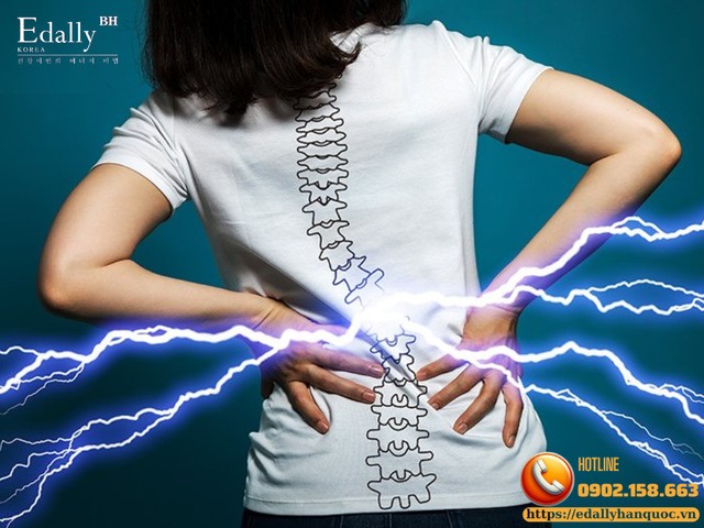 Đau lưng cấp: nguyên nhân, triệu chứng và cách xử trí, phòng ngừa hiệu quả Đau lưng cấp: nguyên nhân, triệu chứng và cách xử trí, phòng ngừa hiệu quả