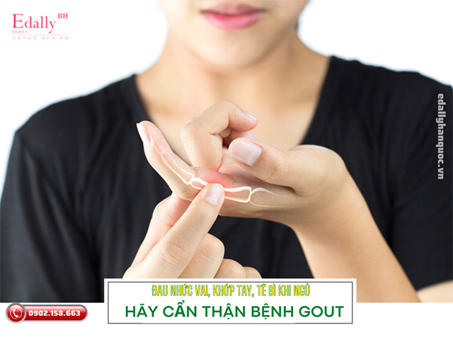 Đau nhức vai, khớp tay, tê bì khi nằm ngủ hãy cẩn thận với bệnh gout