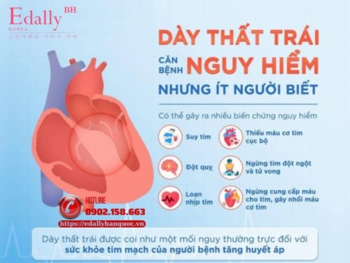 Dày Thất Trái - Căn Bệnh Nguy Hiểm Nhưng Ít Người Biết