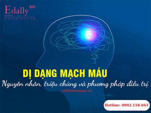 Dị Dạng Mạch Máu Là Gì? Các Loại Dị Dạng Mạch Máu?