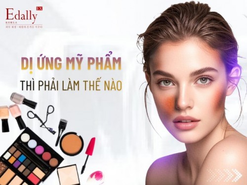 Dị Ứng Mỹ Phẩm Và Cách Xử Lý, Phòng Ngừa Hiệu Quả