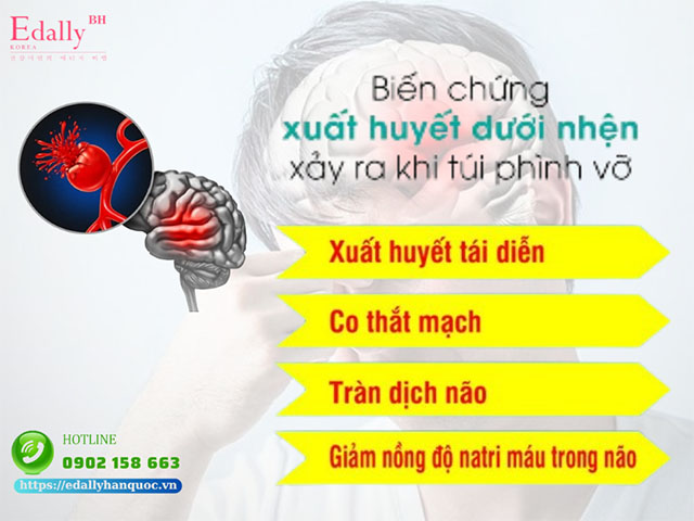 Vỡ túi phình mạch máu não nguy hiểm như thế nào?