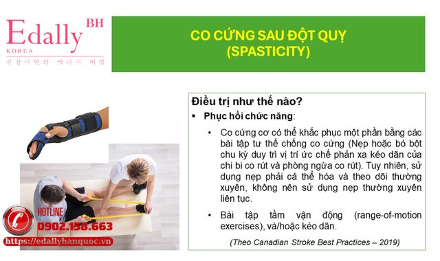 Điều trị co cứng sau đột quỵ não và chấn thương sọ não như thế nào?