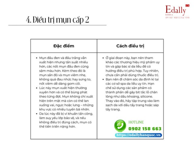 Điều trị mụn cấp 2 đúng cách tại nhà an toàn và hiệu quả