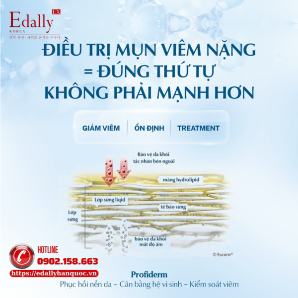 Điều trị mụn viêm nặng cần đúng thứ tự chứ không phải can thiệp mạnh hơn Điều trị mụn viêm nặng cần đúng thứ tự chứ không phải can thiệp mạnh hơn