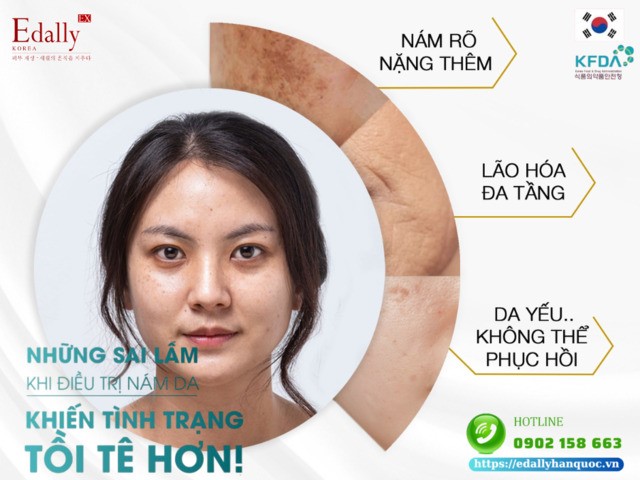 Điều trị nám da sai cách khiến nám da dễ quay trở lại và tình trạng nám da trở nên tồi tệ hơn